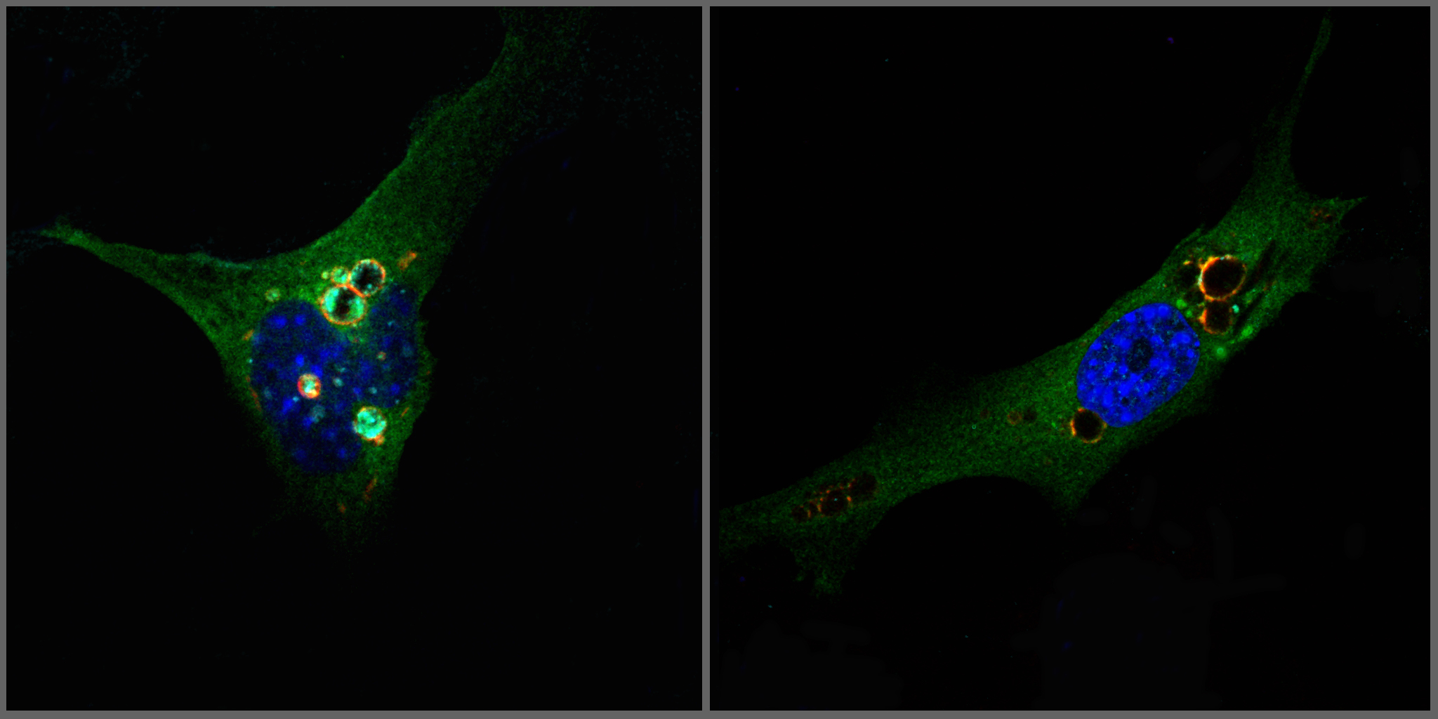 La deficiencia en la proteína DOR favorece la aparición de obesidad