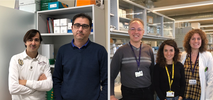 Los anticuerpos frente al colesterol ‘bueno’ están elevados en pacientes con aneurisma aórtico abdominal