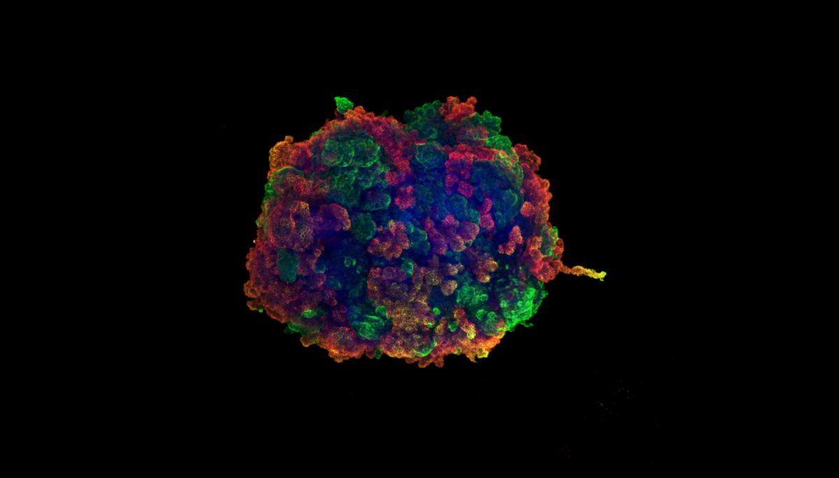 Identifican los genes que actúan como protectores contra las enfermedades renales
