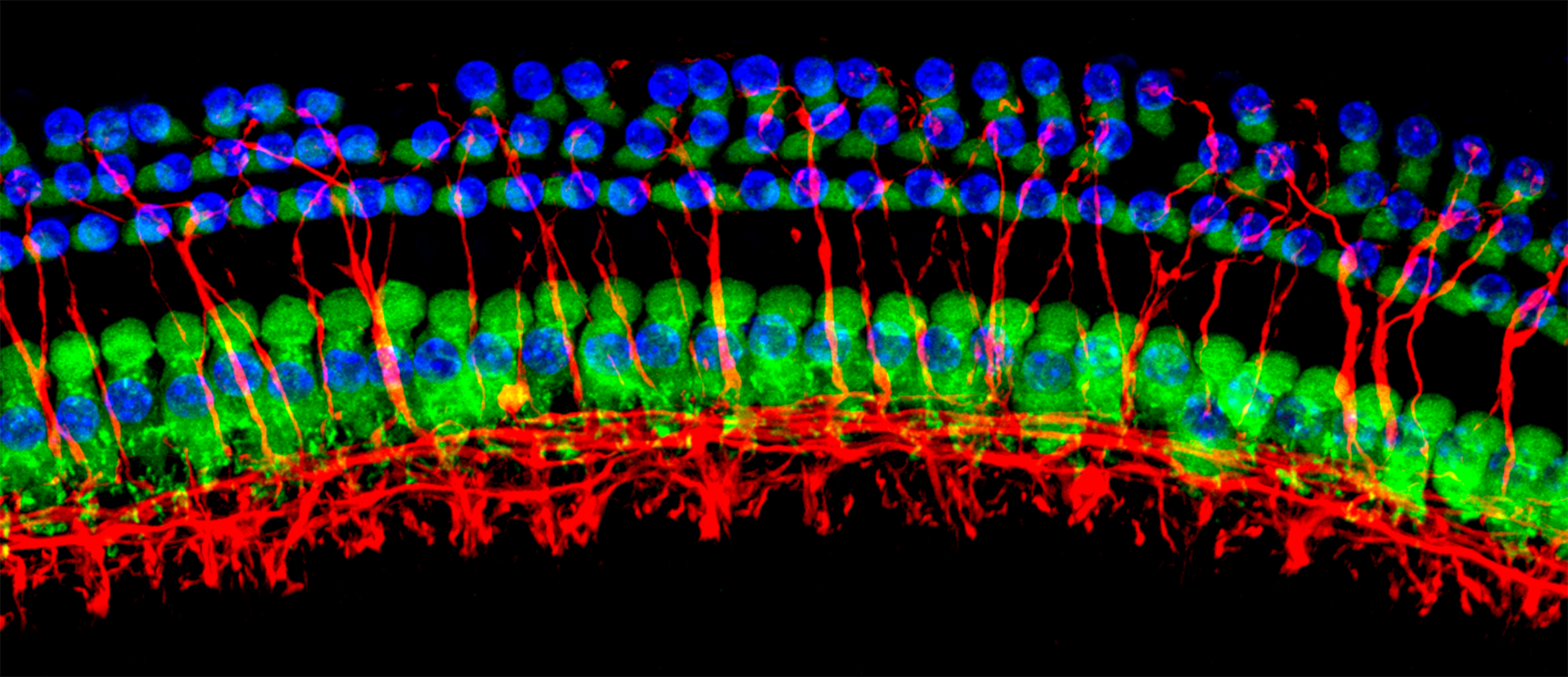 ‘Silencio’ y ‘Gota a gota’, ganadoras del primer Concurso CIBERER de Fotografía sobre Investigación en Enfermedades Raras