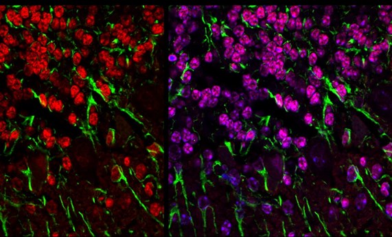 Presentan el primer estudio epidemiológico de enfermedades mitocondriales de España Presentan el primer estudio epidemiológico de enfermedades mitocondriales de España