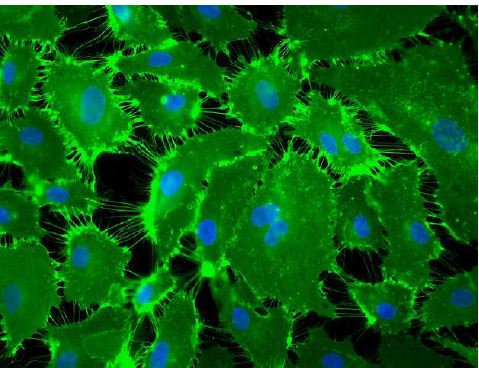 Estudian los mecanismos fisiopatológicos que intervienen en el desarrollo de la hipertensión pulmonar tromboembólica crónica