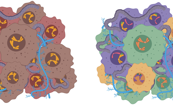 Analizan la relación entre la heterogeneidad genética intratumoral y la agresividad del neuroblastoma Analizan la relación entre la heterogeneidad genética intratumoral y la agresividad del neuroblastoma