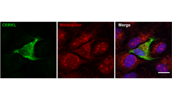 La sobreexpresión del gen causante de la retinosis pigmentaria ‘CERKL’ protege a las mitocondrias de la retina del estrés oxidativo La sobreexpresión del gen causante de la retinosis pigmentaria ‘CERKL’ protege a las mitocondrias de la retina del estrés oxidativo