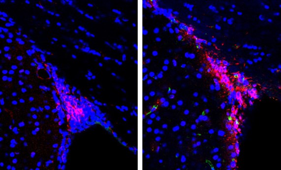 Defectos en la capacidad de migración de las nuevas neuronas podrían causar la pérdida de olfato y otros defectos cognitivos en el Alzheimer