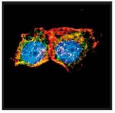 Describen la proteína Espinofilina como un supresor tumoral multifuncional