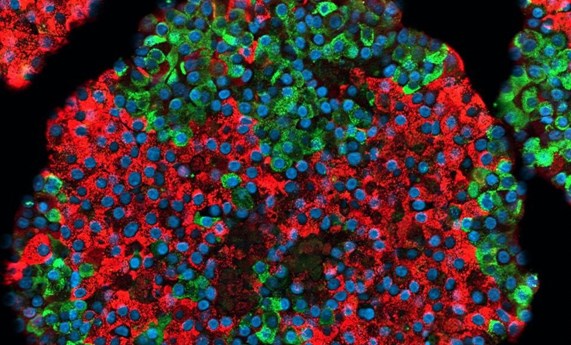 Generan células beta pancreáticas con elevada funcionalidad a partir de células madre Generan células beta pancreáticas con elevada funcionalidad a partir de células madre