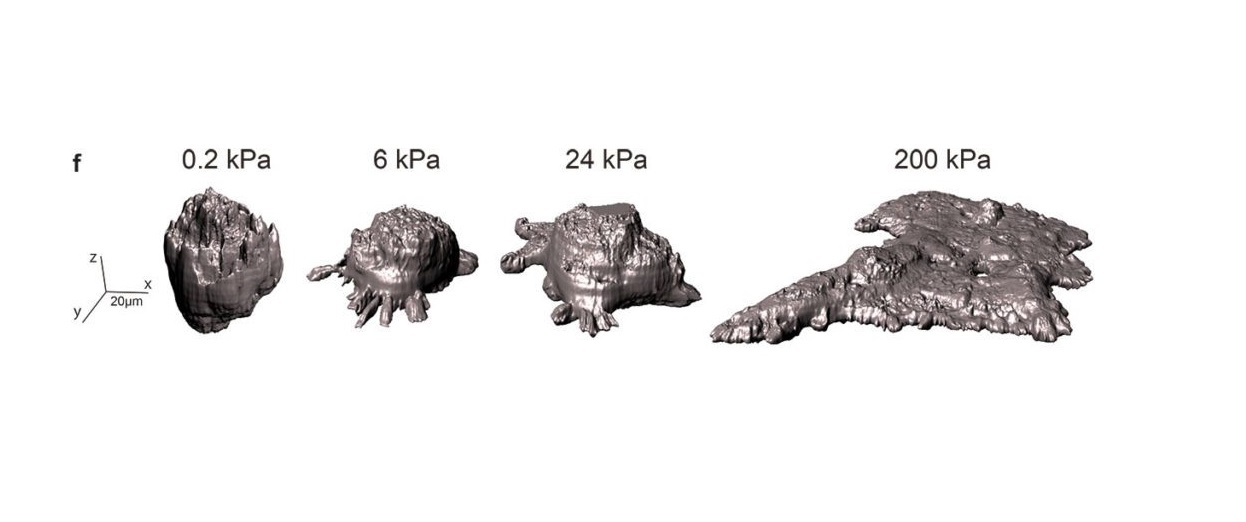Las células cancerosas migran hacia a entornos rígidos como si fueran gotas