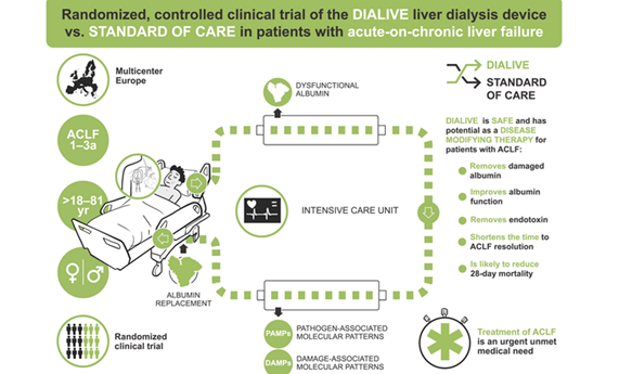 Primera valoración en humanos de un innovador dispositivo de diálisis para la insuficiencia hepática aguda sobre crónica