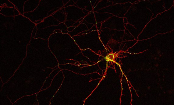 Descubierto un mecanismo molecular relacionado con la muerte de las neuronas Descubierto un mecanismo molecular relacionado con la muerte de las neuronas