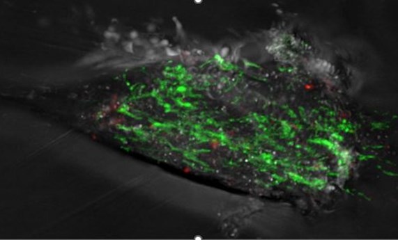 Deleciones en el ADN mitocondrial predicen el Parkinson antes de la aparición de los síntomas