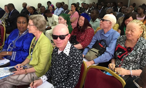 Gran éxito de la primera Reunión internacional sobre albinismo oculocutáneo en África subsahariana Gran éxito de la primera Reunión internacional sobre albinismo oculocutáneo en África subsahariana