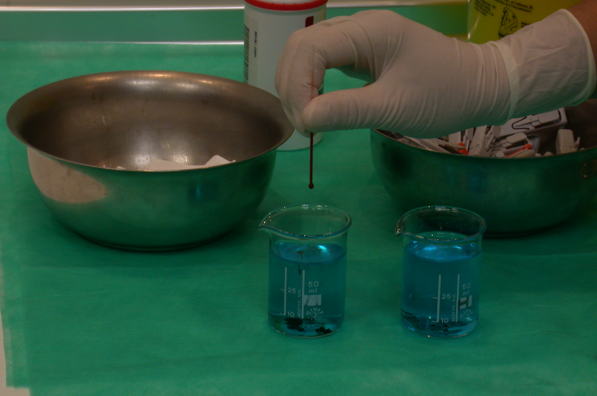 Análisis de sangre facilitarán la idoneidad en los tratamientos psiquiátricos