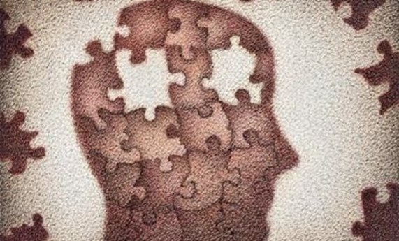 La inflamación “de bajo grado” en esquizofrenia está regulada por los receptores de inmunidad innata La inflamación “de bajo grado” en esquizofrenia está regulada por los receptores de inmunidad innata