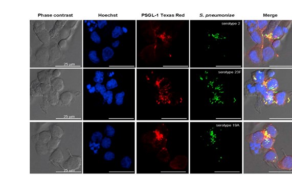 Identificado un nuevo receptor del sistema inmune frente a la infección neumocócica invasiva Identificado un nuevo receptor del sistema inmune frente a la infección neumocócica invasiva
