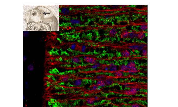 La vulnerabilidad a padecer adicciones podría gestarse en los primeros momentos del desarrollo del cerebro La vulnerabilidad a padecer adicciones podría gestarse en los primeros momentos del desarrollo del cerebro