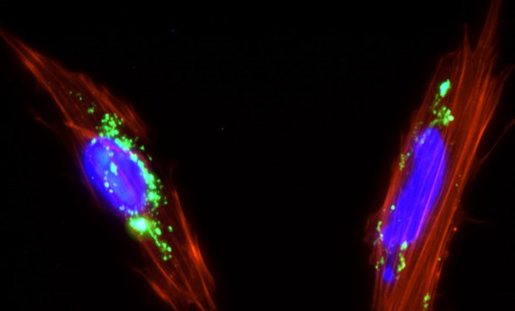 Usan células madre de placenta como vehículo para llevar fármacos al interior de los tumores Usan células madre de placenta como vehículo para llevar fármacos al interior de los tumores