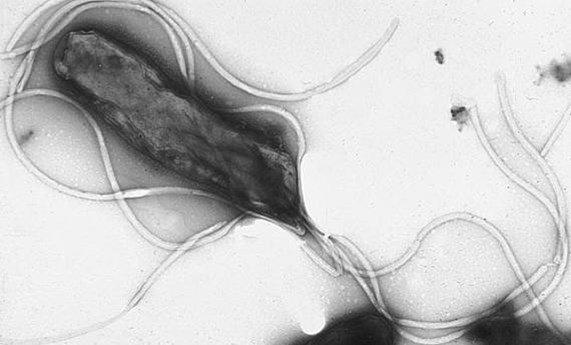 Se publica el consenso para optimizar el tratamiento de la bacteria 'Helicobacter pylori', que afecta a la mitad de la población española Se publica el consenso para optimizar el tratamiento de la bacteria 'Helicobacter pylori', que afecta a la mitad de la población española