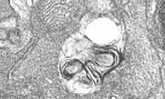 La autofagia resuelve la inflamación retiniana causada por el déficit en IGF-1 en el ratón- La autofagia resuelve la inflamación retiniana causada por el déficit en IGF-1 en el ratón-