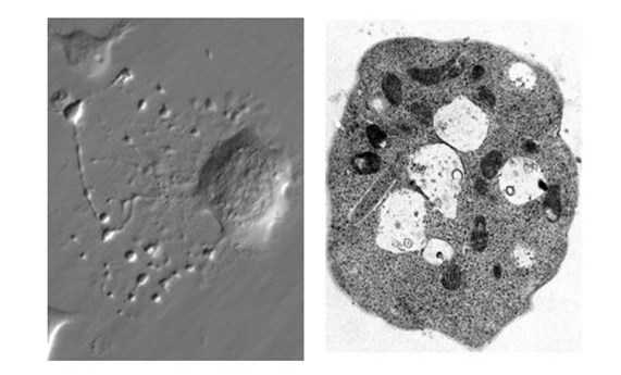 Investigadores del CIBER-BBN coordinan un estudio que ha convertido células de la piel en plaquetas Investigadores del CIBER-BBN coordinan un estudio que ha convertido células de la piel en plaquetas