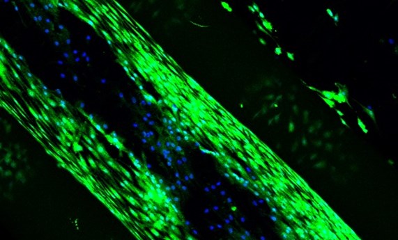 Desarrollan sistemas de bioimpresión 3D y biotintas para la regeneración de cartílago y hueso Desarrollan sistemas de bioimpresión 3D y biotintas para la regeneración de cartílago y hueso