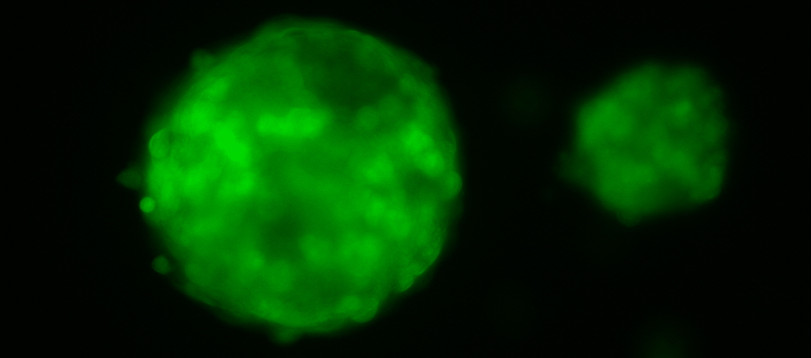 Un adenovirus oncolítico presenta sinergias con dos fármacos en el tratamiento de tumores pancreáticos en una prueba de concepto
