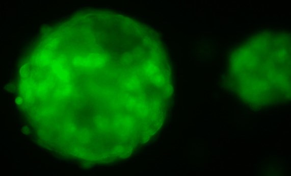 Un adenovirus oncolítico presenta sinergias con dos fármacos en el tratamiento de tumores pancreáticos en una prueba de concepto Un adenovirus oncolítico presenta sinergias con dos fármacos en el tratamiento de tumores pancreáticos en una prueba de concepto