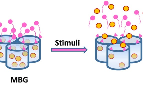 Idean nuevos implantes para el tratamiento de infecciones y tumores óseos Idean nuevos implantes para el tratamiento de infecciones y tumores óseos